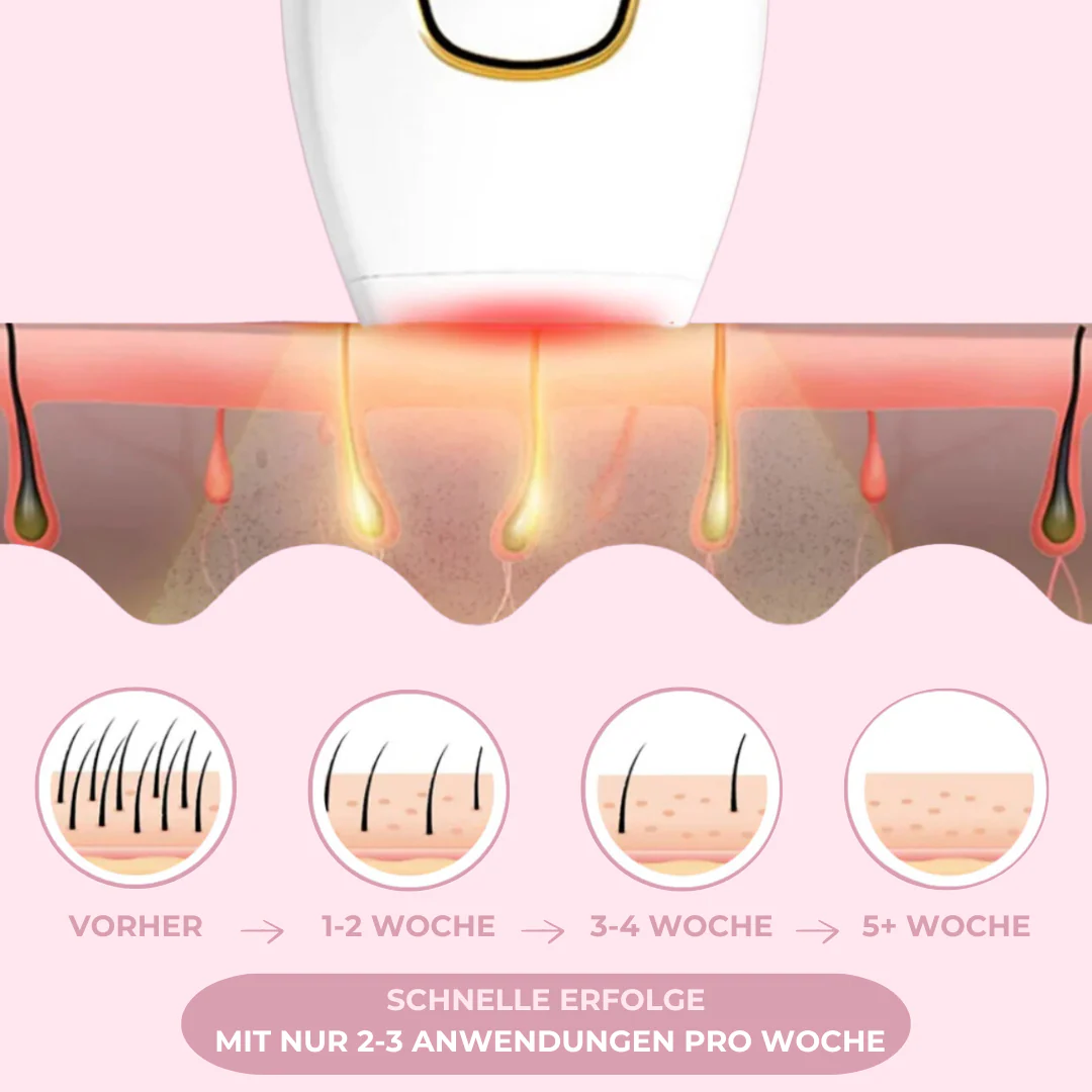 GLIMORA®  - IPL Haarentfernung