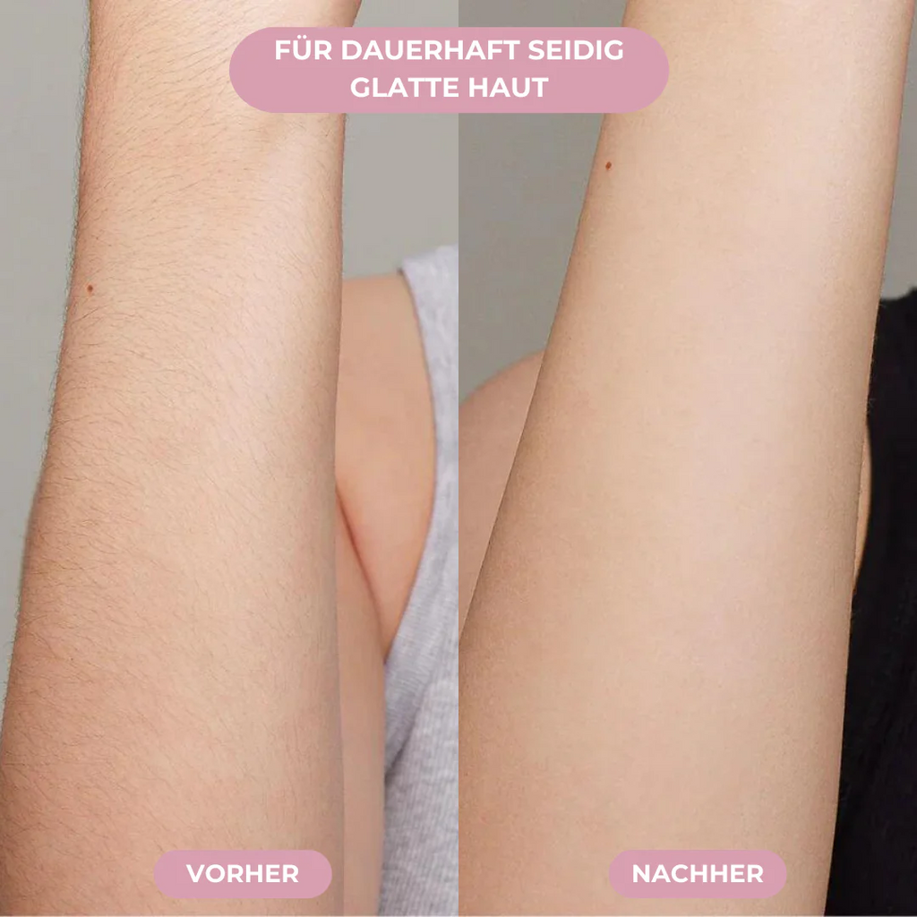 GLIMORA®  - IPL Haarentfernung