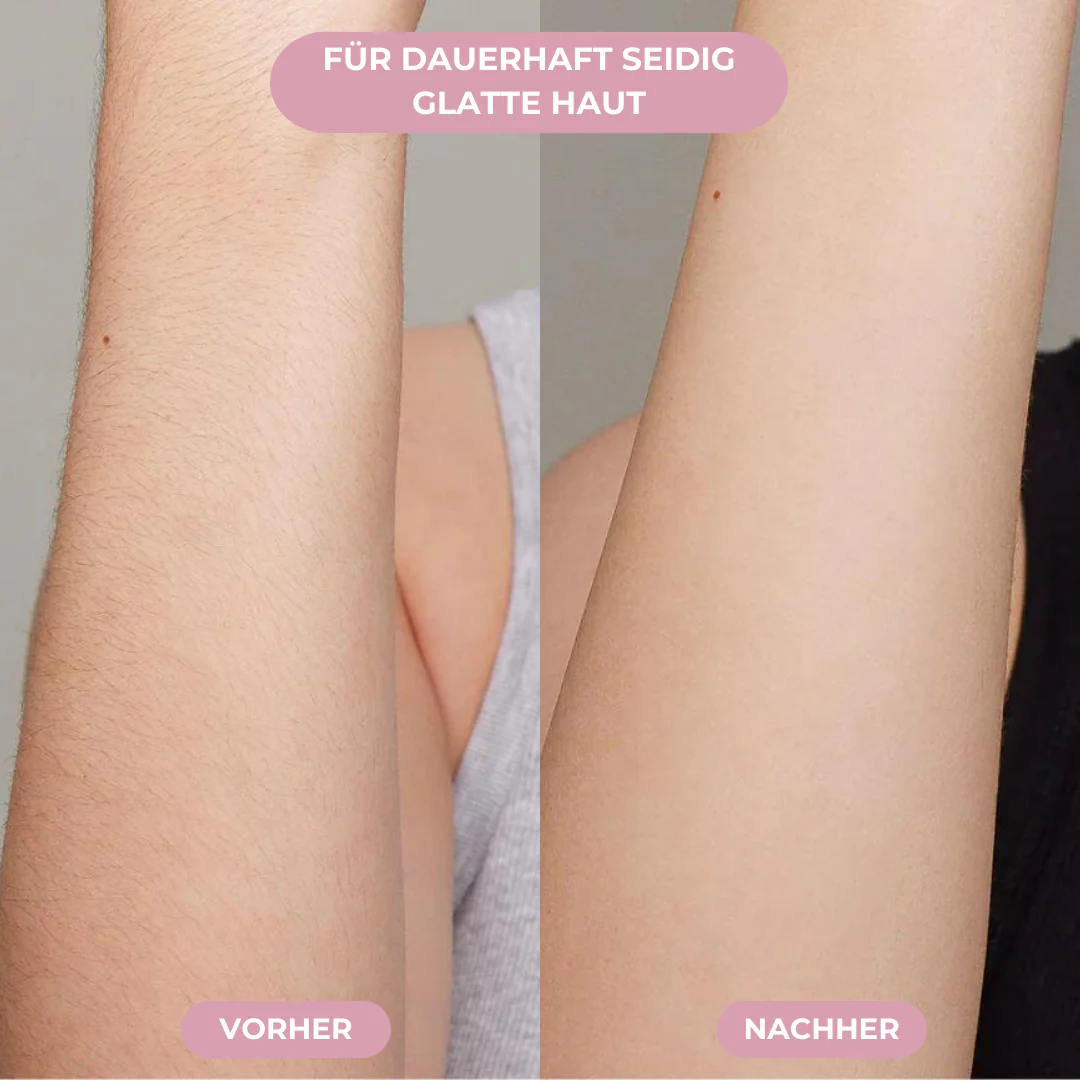 GLIMORA®  - IPL Haarentfernung
